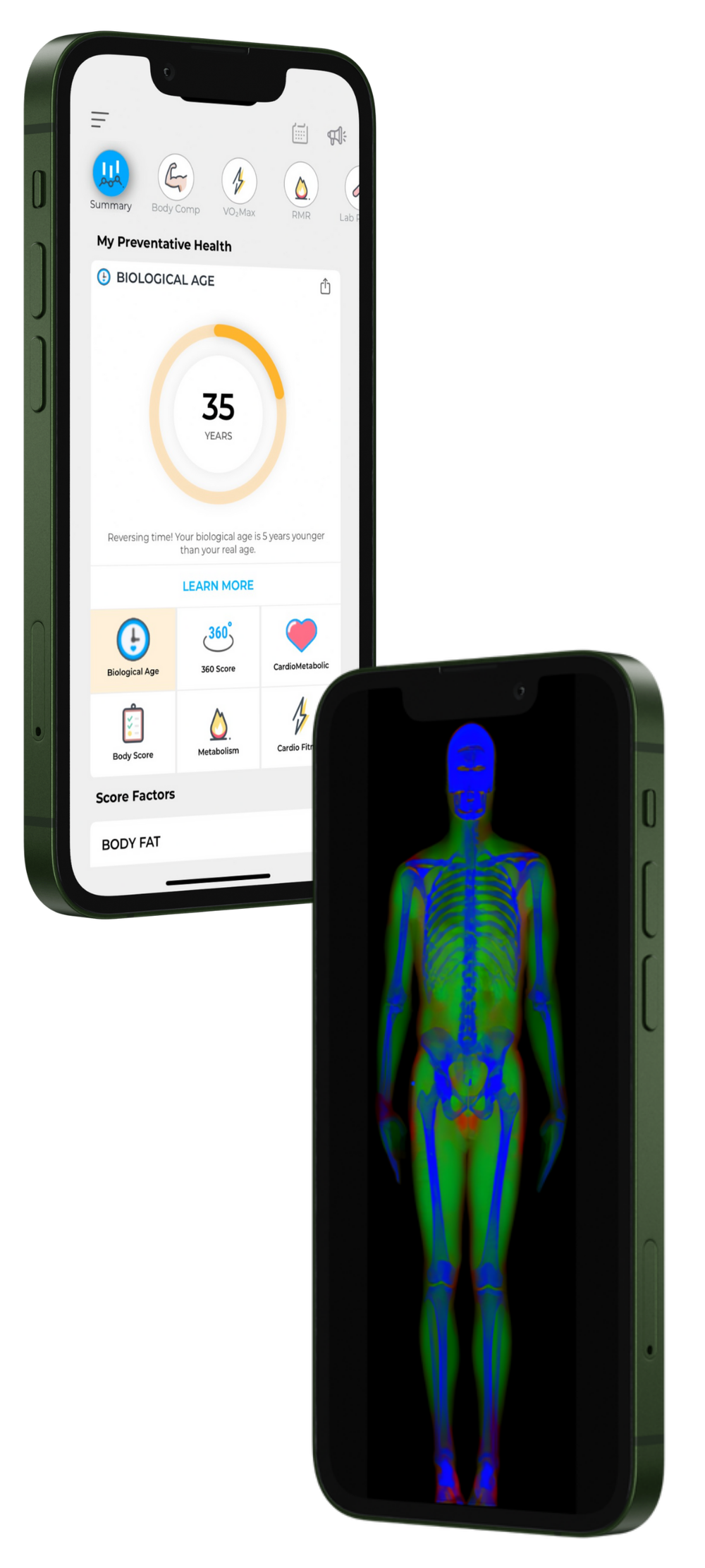 DexaFit body composition heatmap report